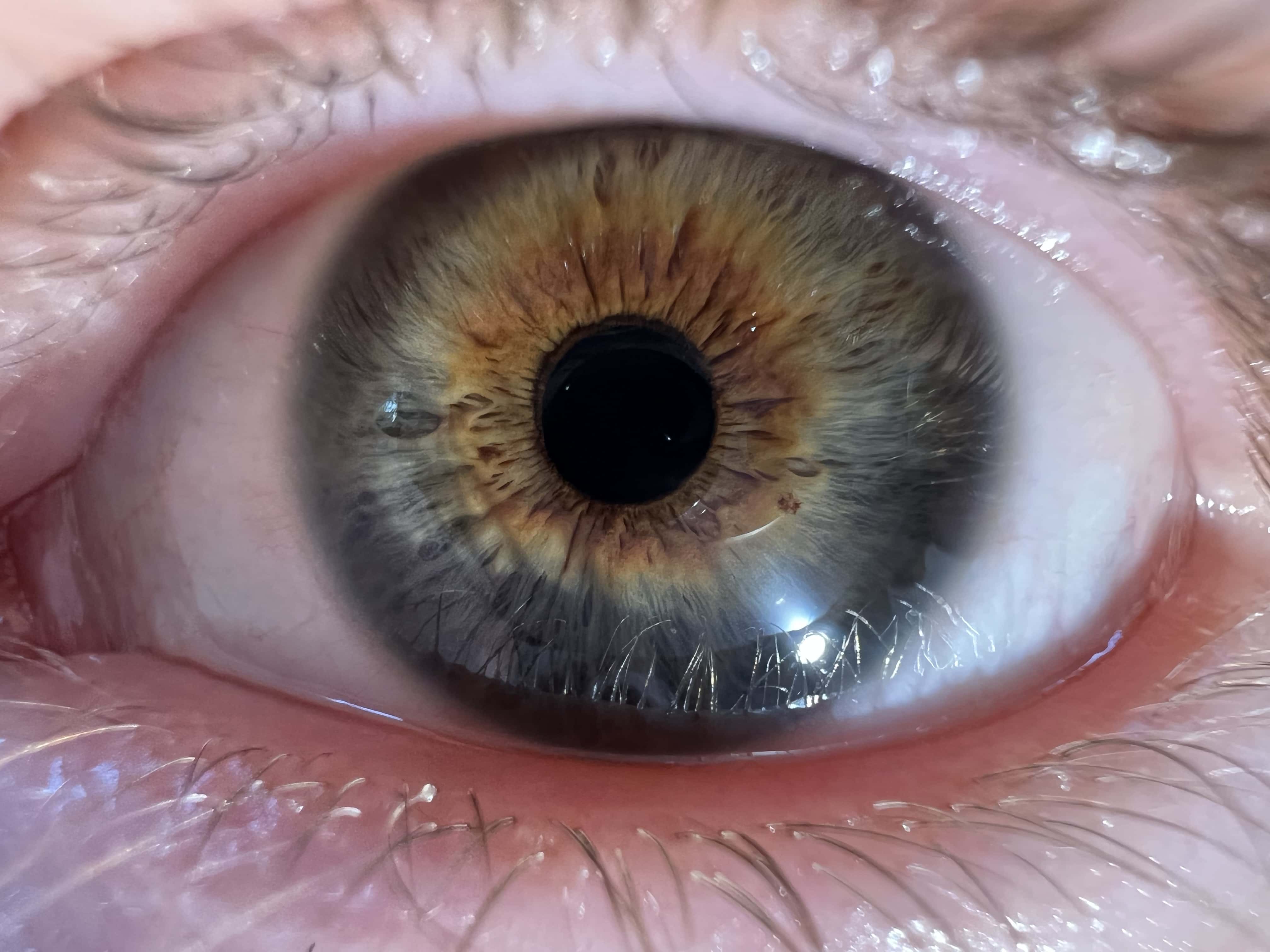 IMG_2526 Macro test shot of eyeball from iPhone 13 Pro. Look at that detail in the iris!