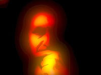 post-3099-image-6edaf9680cd49ccba70941f888811a58-jpg