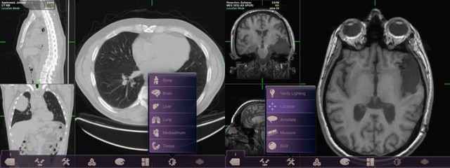 Mobile MIM is an iOS app used for viewing medical images like x-rays and ultrasound