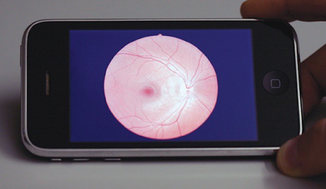 Even without a retina display, the iPhone 3G delivers a better view of a retina than a PC.