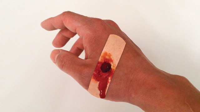 A small cut becomes a small-caliber bullet wound with "Boo-Boos Bandages." Photo: Sherwood Forlee
