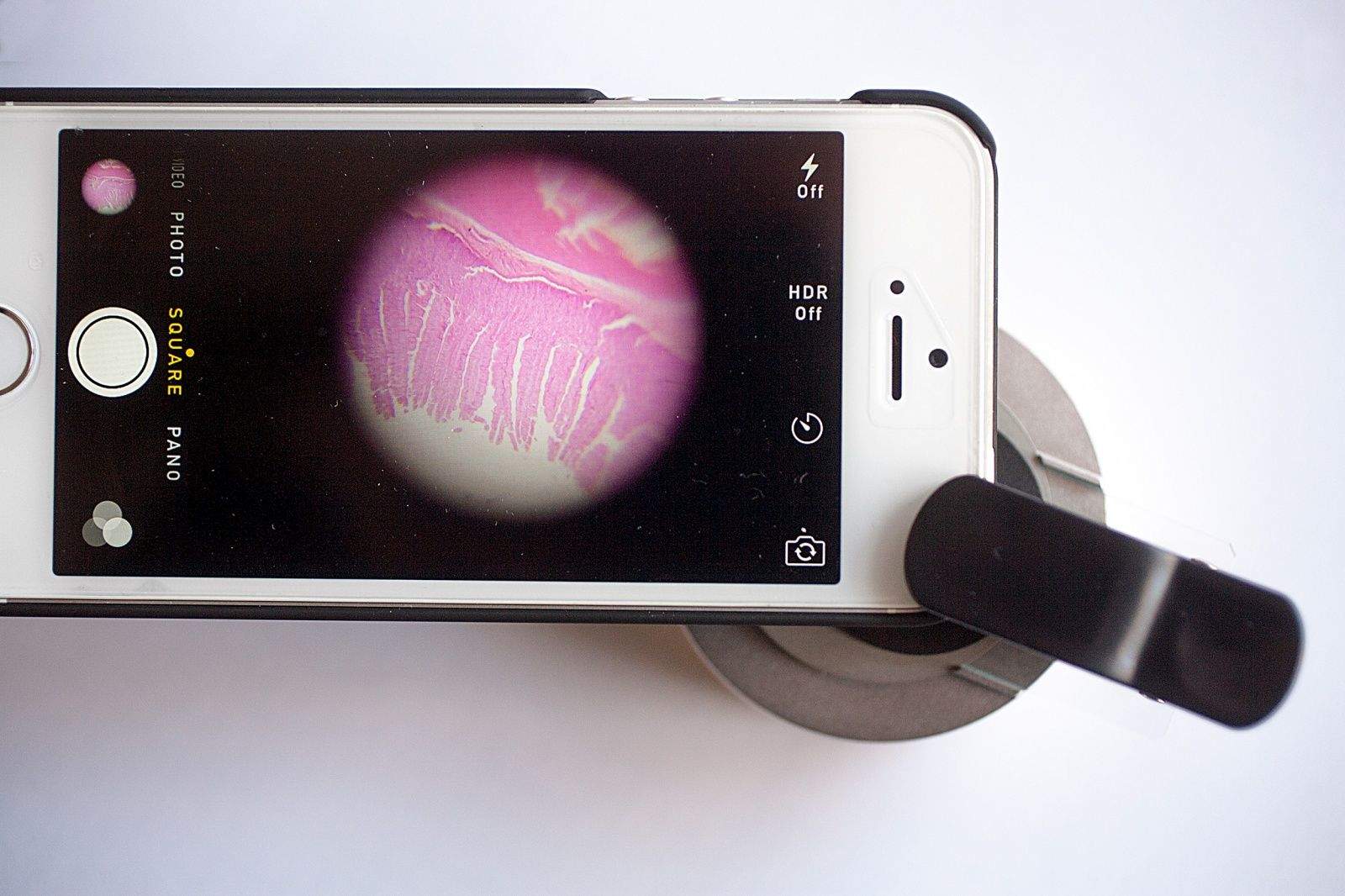 The uHandy kit turns an iPhone's camera app into a mobile microscope. Photo: David Pierini/Cult of Mac