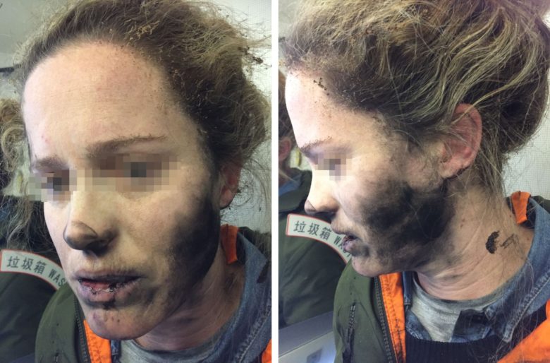 Apple blames third-party battery for exploding headphones