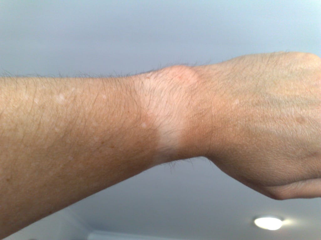 Apple Watch tan line