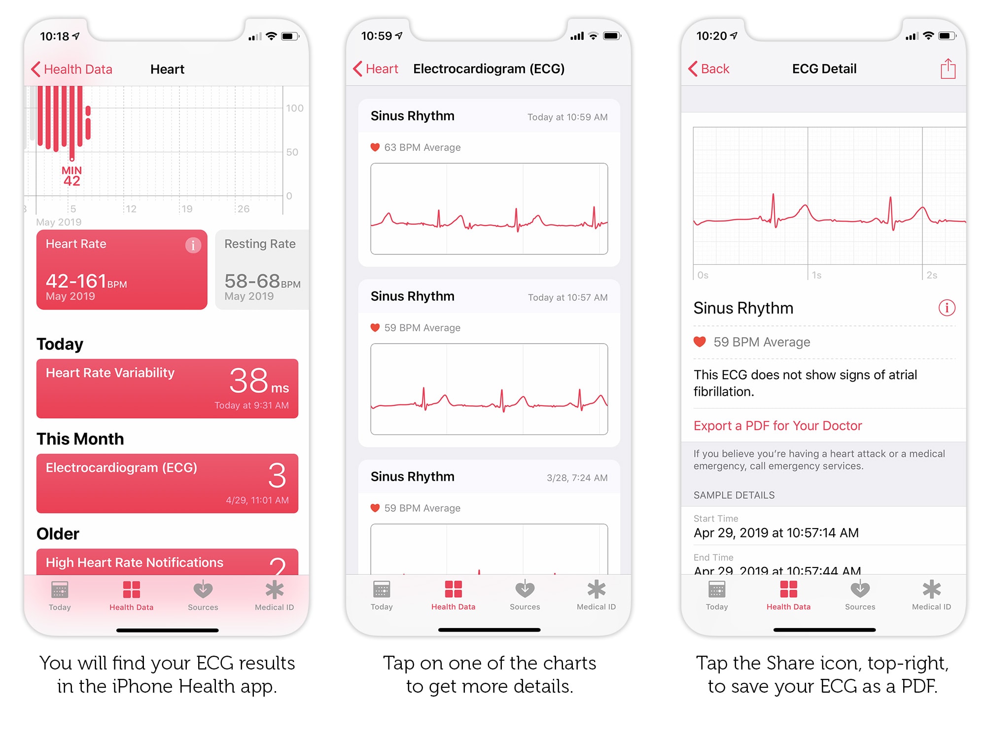 How to export your Apple Watch ECG result as a PDF to show your doctor