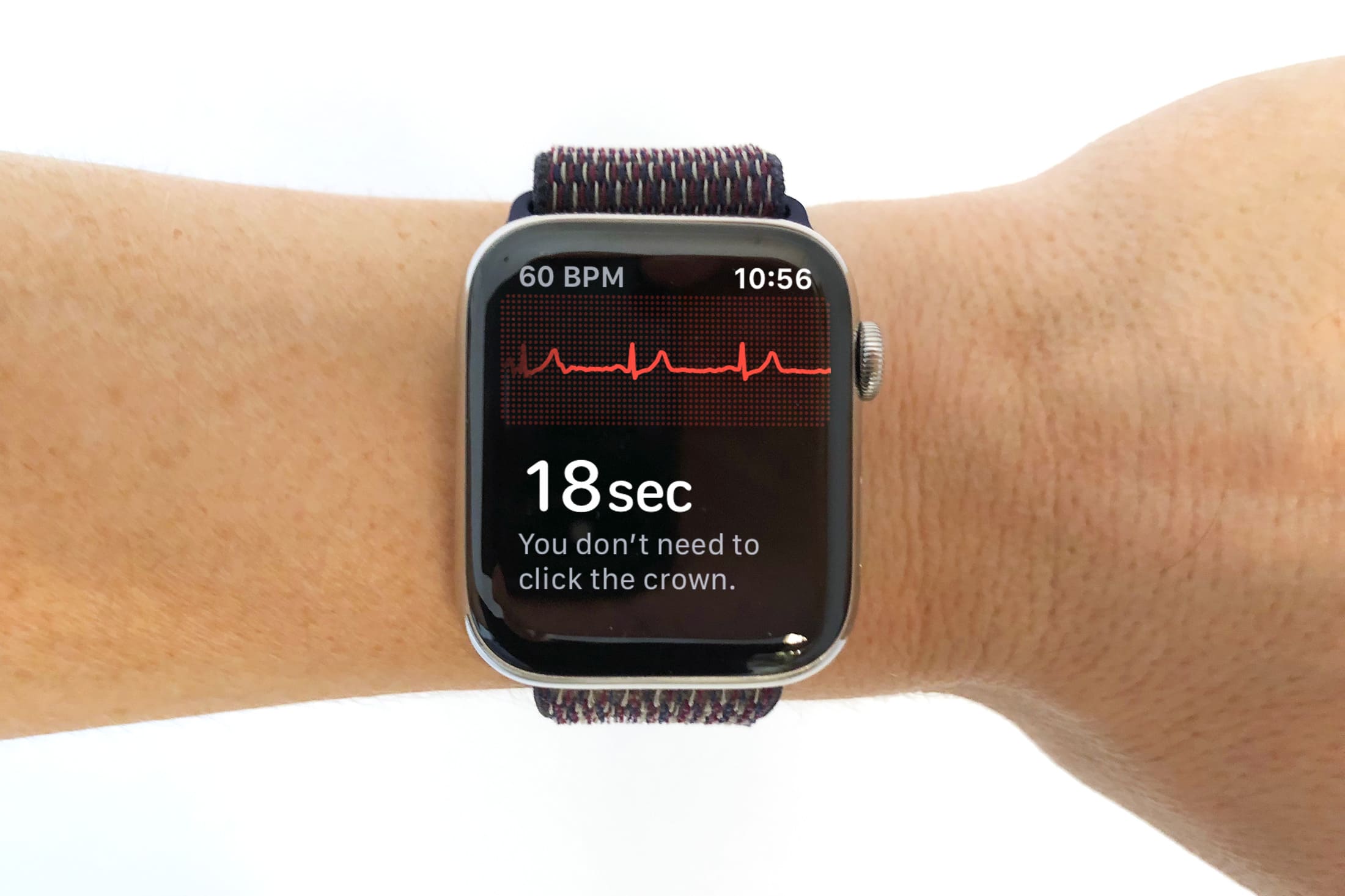 Apple Watch may have saved the life of a 79-year-old with heart condition