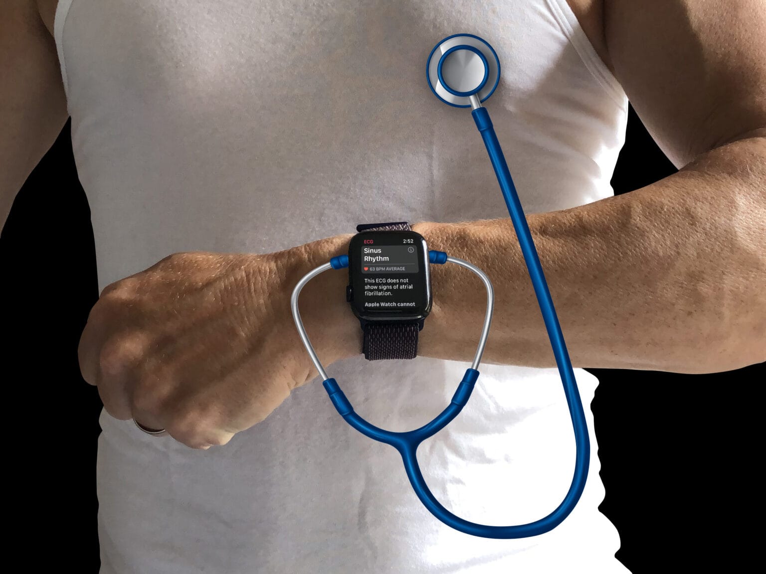 Does Apple Watch need more health sensors?